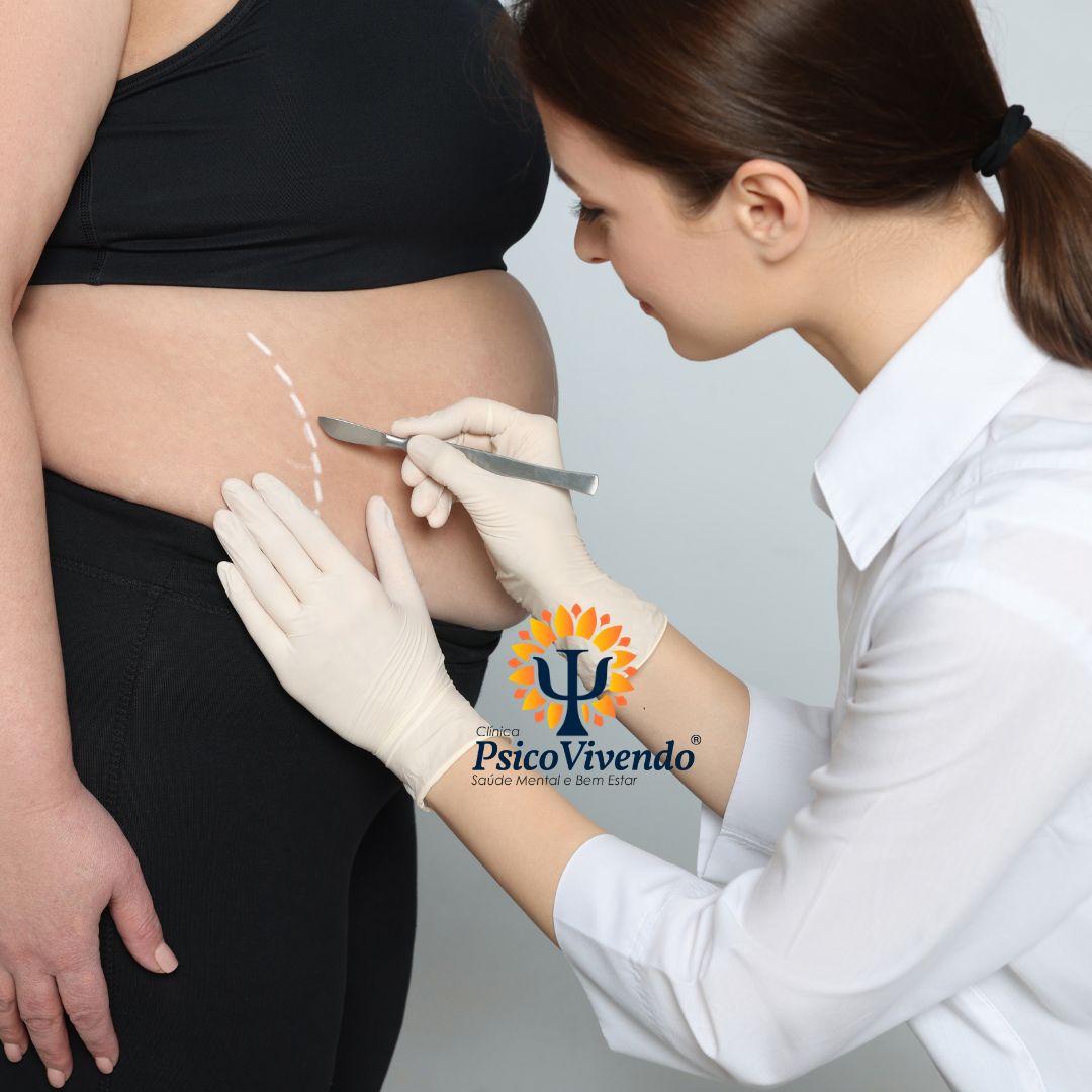 Avaliação e Acompanhamento Psicológico para Cirurgia Bariátrica